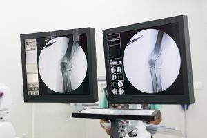 Arco cirúrgico proporciona ‘foco’ da região a ser operada