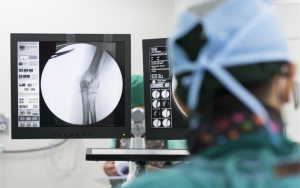 Fluoroscopia: Imagens de raio-X em alta resolução e tempo real