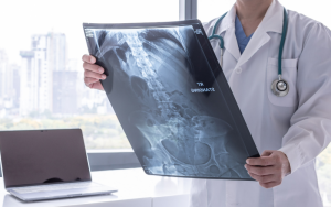8 de novembro: Dia Internacional do radiologista
